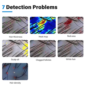 เครื่องนวดหนังศีรษะอัจฉริยะ3 Spectra Ai เครื่องนวดหนังศีรษะแบบมืออาชีพ - Product Image 3