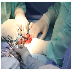 Ciseaux chirurgicaux droits en acier au carbure de tungstène de 10 1/2 \ "base d'équipement d'obstétrique et de gynécologie pour l'hystérectomie - Product Image 5