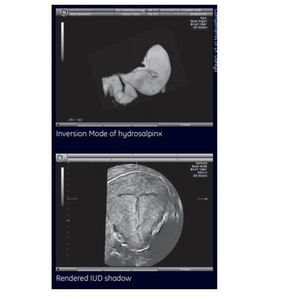 Appareil d'échographie GE Voluson 730 d'occasion, OEM/ODM, portable, pour obstétrique/gynécologie et imagerie générale - Product Image 5