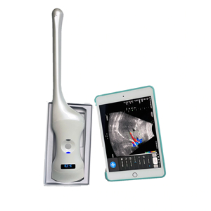 Échographe Doppler couleur sans fil 3-en-1 à sonde linéaire convexe ou phasée à prix avantageux MSLAA114. Équipement - Product Image 1