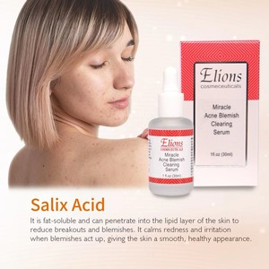 Sérum Visage Anti-Acné à l'Acide Salicylique B.H.A. pour Éliminer les Points Noirs et les Imperfections, Soin Éclaircissant et Réducteur de Pores pour Peaux Grasses - Product Image 4