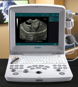 เครื่องอัลตราซาวนด์ดอปเปลอร์แบบพกพาขนาดกะทัดรัด EDAN DUS 60 - Product Image 4