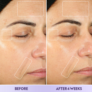 Kit de Produtos Coreanos de Cuidados com a Pele Antienvelhecimento, Clareador e Iluminador de Marca Própria: Sérum Facial, Creme Anti-Rugas para OEM - Product Image 5