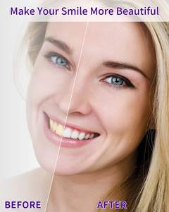 Kit de blanchiment des dents V34, sérum correcteur de couleur violet, poudre mousse, ensemble pour éliminer les taches jaunes, sourire éclatant instantané, OEM - Product Image 4