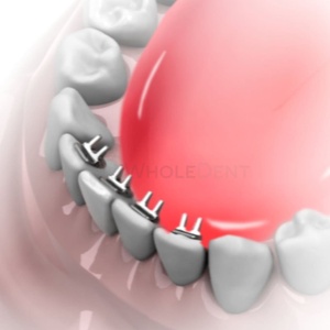 Morelli <b>Mini</b> Spur Tongue Educator 10 <b>pcs</b> Oral Therapy Equipment & Accessory Educator - Product Image 3