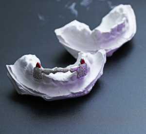 2023 à la mode unisexe luxe 10k or massif dents gril Provence personnalisable pierre principale diamant Fine Piercing bijoux personnalisé - Product Image 4