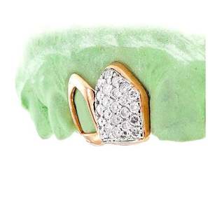 Custom Gold or Silver <b>Grillz</b>-2 Piece Diamond Dust Double Cap Trillion Cut Incisor and Fang-<b>Fine</b> Pendants & Charms - Product Image 3