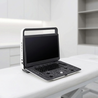 SonoScape E1V Sistema de Diagnóstico por Ultrasonido Portátil Veterinario en Blanco y Negro para Clínica Veterinaria y Uso en Granjas, Dispositivo de Imagenología en Blanco y Negro
