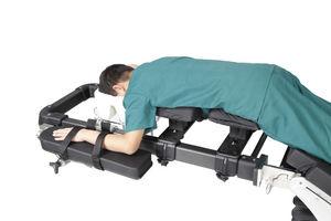 Estructura de Fibra de Carbono Eléctrica para Sistema de Columna Vertebral para Mesa Quirúrgica de Cirugía Ortopédica - Product Image 2