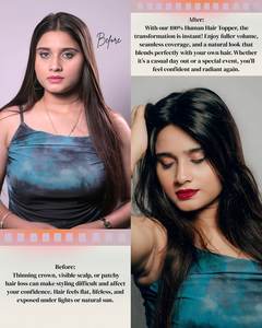 3x5 Premium Quality Remy <b>Hair</b> <b>Extension</b> 100% Tangle-Free Natural Brown and <b>Black</b> Indian Silk Base Topper 100 Gram Weight - Product Image 5