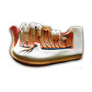 Lowe Jaw de un preadolescente de un niño de once años muestra Dientes deciduos siendo reemplazados por Laboratorio de Biología permanente - Product Image 1