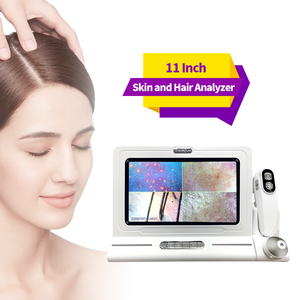 Chuyên NGHIỆP 4 phổ HD da đầu da Phân Tích Máy quét 200X 50x Độ phóng đại USB Màn hình cảm ứng cho Thẩm mỹ viện chăm sóc tóc phòng khám - Product Image 6