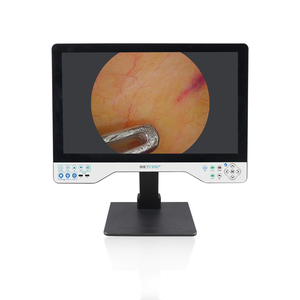 טלפאק 24 אינץ 'fhd צג מסך אנדוסקופ כלי נגינה כירורגיים עבור ארינגוסקופ - Product Image 6