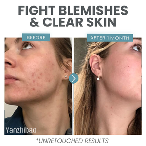 Oem Vitamin C huyết thanh 1oz chất lỏng không dầu-mụn trứng cá đốm đen & chống lão hóa với axit salicylic & axit hyaluronic - Product Image 3