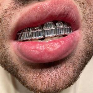 Luxury 2023 Trendy Style Custom Grillz 14K Gold Plated Sterling <b>Silver</b> IGI Certified Moissanite Claw Setting Vintage Unisex - Product Image 3