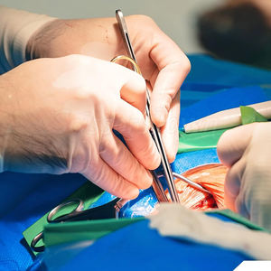 Poignée de Scalpel chirurgical médical Poignée BP avec poignée ergonomique pour une coupe de précision et une durabilité durable - Product Image 3