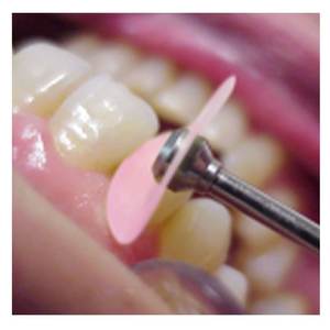 Disques de finition et de polissage Praxis pour composites, système de mandrin à encliquetage, séquence complète de polissage - Product Image 3