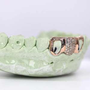 Grillz Hip Hop Exclusifs en Argent Sterling 925 avec Diamants Moissanite - Cadeau de Fiançailles pour un Style Unique - Product Image 2