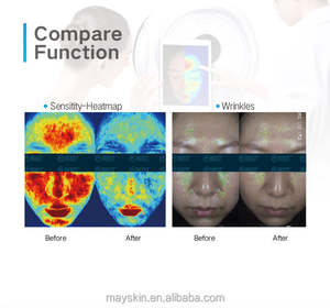 Escáner Facial Completo con Tecnología IA MC10, Equipo Analizador de Piel con Funciones de Hidratación para la Unión Europea, Estados Unidos y Sudáfrica - Product Image 3