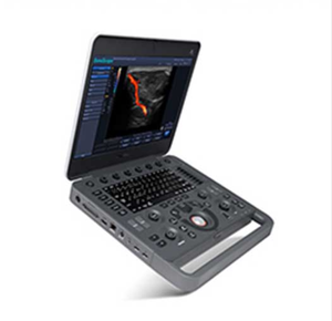 D0pp1er c0l0r p0rtab1e X5พร้อม pr0be abd0m1nal - Product Image 1