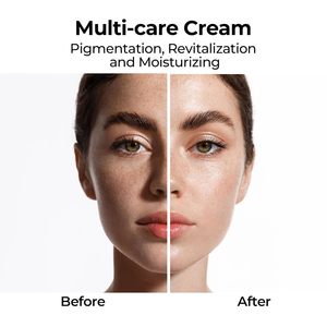 <b>Korean</b> Skincare Products <b>Dark</b> <b>Spot</b> Skin <b>Whitening</b> <b>Cream</b> MEDI-PEEL MeLanon X <b>Cream</b> 30ml - Product Image 4
