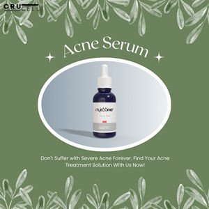 2025 nueva llegada Crucell modificado Jessener Peel blanqueamiento de la piel eliminación del acné Peel químico 30mL líquido de alta calidad para la cara - Product Image 5