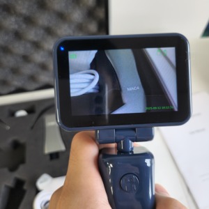 Videolaringoscopio Portátil HD con Pantalla LCD de 10.1 Pulgadas, Hoja de Acero Inoxidable Reutilizable para Intubación en Anestesia Pediátrica y de Adultos - Product Image 5