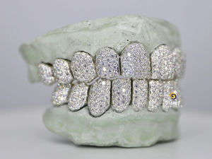 Hip Hop Personalidad Grillz Dientes Top Bottom Set con VVS Clarity Moissanite Diamond Iced Out Custom 925 Sterling Silver Grillz - Product Image 2
