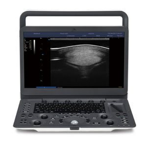 SonoScape E2 ProV Sistema de Ultrasonido Doppler Color Veterinario Portátil con Una Sonda, Escáner de Ultrasonido E2 Pro, Precio de Distribuidor - Product Image 2