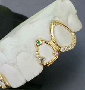 Luxe de haute qualité exclusif Moissanite diamant Grillz plaqué or Bling glacé pour les mariages, les fiançailles et les cadeaux - Product Image 4