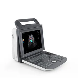 Pemindai Doppler warna mesin Ultrasound diagnostik M5 12.1 inci ZONCARE untuk klinik