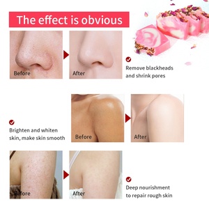 Jabón en Barra de Pétalos de Rosa Natural Orgánico Prensado en Frío Hecho a Mano para el Cuidado de la Piel Yoni de Marca Privada - Product Image 3