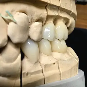 Honchon 3D Plus ml Dentaire Zircone <span class=keywords><strong>Dents</strong></span> Artificielles Couronne Produits Dentaires Zircone Bloc De Céramique - Product Image 5