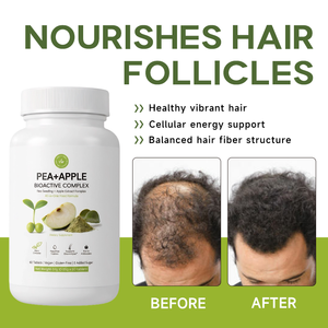 Tabletas de Apoyo al Crecimiento del Cabello con Fórmula Natural a Base de Plantas, Personalizables, <span class=keywords><strong>para</strong></span> la Salud del Cabello y la Pérdida del Cabello - Product Image 1
