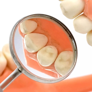 Tête de miroir buccal dentaire de qualité supérieure Miroir buccal de diagnostic dentaire à surface avant en rhodium Miroir buccal à double face en rhodium - Product Image 5