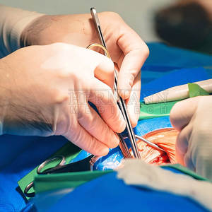 Couteau à <span class=keywords><strong>scalpel</strong></span> chirurgical manuel en acier inoxydable de haute qualité professionnel, réutilisable, pour usage hospitalier et de laboratoire, stérile ISO13485 - Product Image 3