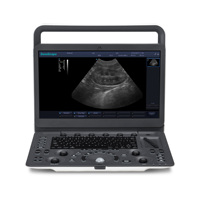 Ecógrafo Veterinario SonoScape E1V con Sonda Rectal L741V, Maleta y Cubierta de Teclado para Reproducción y Cría Equina