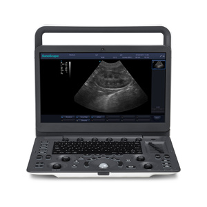 Échographe vétérinaire SonoScape E1V avec sonde rectale L741V, housse de clavier pour valise, pour la reproduction et l'élevage équin - Product Image 2