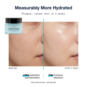 Crème Visage Réparatrice Barrière Cutanée à l'Acide Hyaluronique et Céramide Marque Blanche 50ml pour Peaux Sèches et Sensibles Hydratation 72H Vente en Gros OEM - Product Image 2