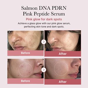 [Vendita] Medicube rosa PDRN Peptide siero fiale 30ml per la cura delle rughe coreano crema idratante per la cura della pelle e crema corea bellezza