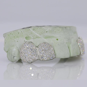 Dientes de plata 925 personalizados de Hip Hop para hombre Grillz Iced out Moissanite Diamond Grillz Teeth on White Gold Chain Best Price Jewelry - Product Image 2