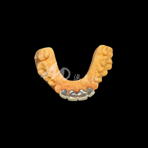 Pont <span class=keywords><strong>dentaire</strong></span> PFM : Conçu avec l'expertise <span class=keywords><strong>dentaire</strong></span>, conçu pour un confort durable - Product Image 4