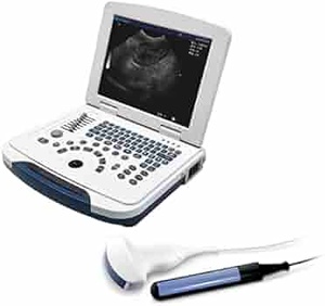 Máquina de ultrasonido portátil digital Escáner ultrasónico humano B CE ISO 5 sondas - Product Image 5