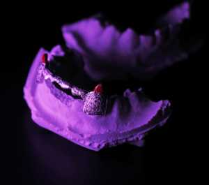 2023 à la mode unisexe luxe 10k or massif dents gril Provence personnalisable pierre principale diamant Fine Piercing bijoux personnalisé - Product Image 3