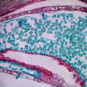 Kính hiển vi sinh học quang học BestScope BS-2044 Infinity với hệ thống chiếu sáng Koehler, khả năng phát quang, tương phản pha, trường tối - Product Image 3