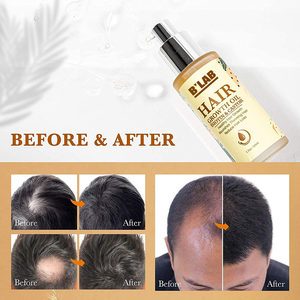 Olio per capelli Premium biotina pro-Growth per capelli dall'aspetto più pieno e più spesso migliora la secchezza Spray anticaduta dei capelli - Product Image 5
