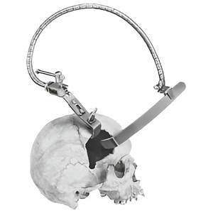 Sistema de Retractor Cerebral Neuroquirúrgico Leyla de Acero Inoxidable Personalizado, Brazo Retractor Autoestático Manual - Product Image 3