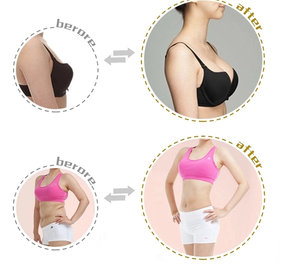 Machine à Ventouses pour Agrandissement des Fesses, Machine de Lifting des Seins des fesses, <span class=keywords><strong>Drainage</strong></span> <span class=keywords><strong>Lymphatique</strong></span>, Thérapie par Ventouse Sous Vide - Product Image 5