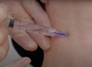 นาโนซอฟท์ 34G นาโนนีดเดิล 3 หัวเข็ม ขนาด 0.6 มม. 0.8 มม. 1.0 มม. 1.2 มม. 1.5 มม. สำหรับฟื้นฟูผิว นาโนซอฟท์ อากูจาส - Product Image 4