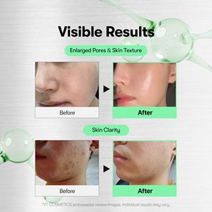 VT CICA Reedle Shot Whitening Ampoule Serum-Korean Skincare Pore Shrinking Moisturizer Face Care Box Packaging Made in Korea - Product Image 3